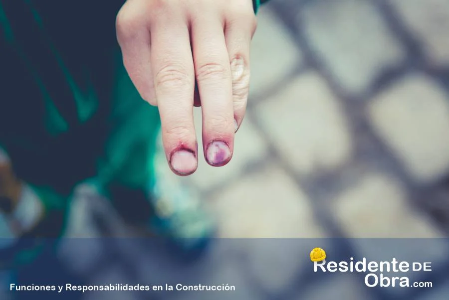 Las Enfermedades más Frecuentes que le Ocurren a los Trabajadores en la Construcción 17 RESIDENTE de OBRA - IMAGEN - Las Enfermedades más Frecuentes que le Ocurren a los Trabajadores en la Construcción - 10
